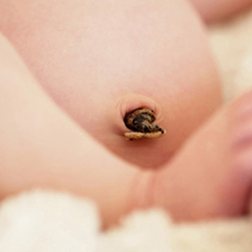 新生儿脐带如何护理 新生儿系带护理注意事项