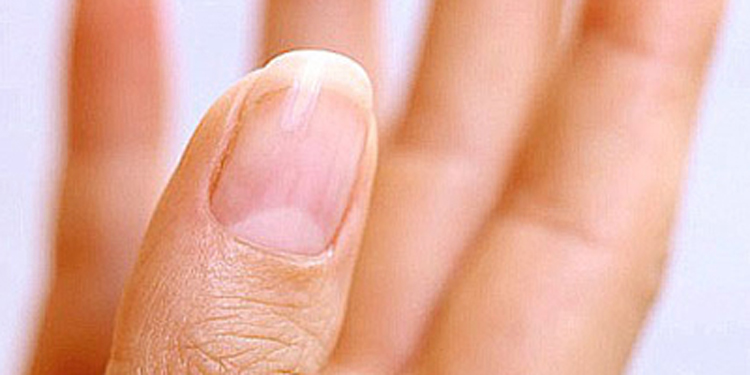 指甲上的半月痕你懂多少 与身体健康有密切关系