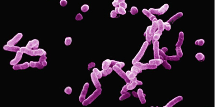家庭细菌的危害 盘点十大家庭细菌聚集地