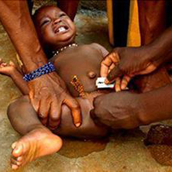 非洲女孩割礼图解全过程：惨不忍睹