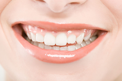 美白牙齿的小窍门推荐 保护牙齿的注意事项分析