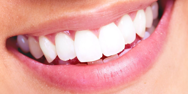 美白牙齿简单方法 展露迷人笑容