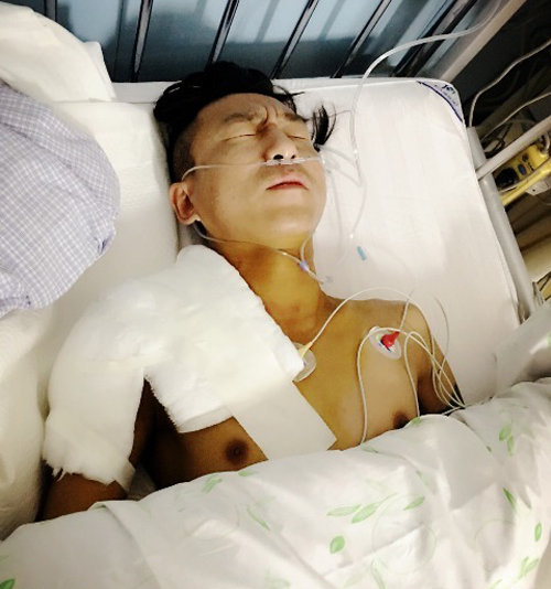 陈羽凡锁骨骨折手术成功 病床上表情痛苦